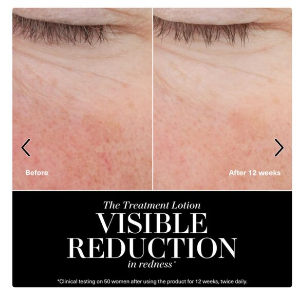 La Mer - The Treatment Lotion - Picture 3 of 9